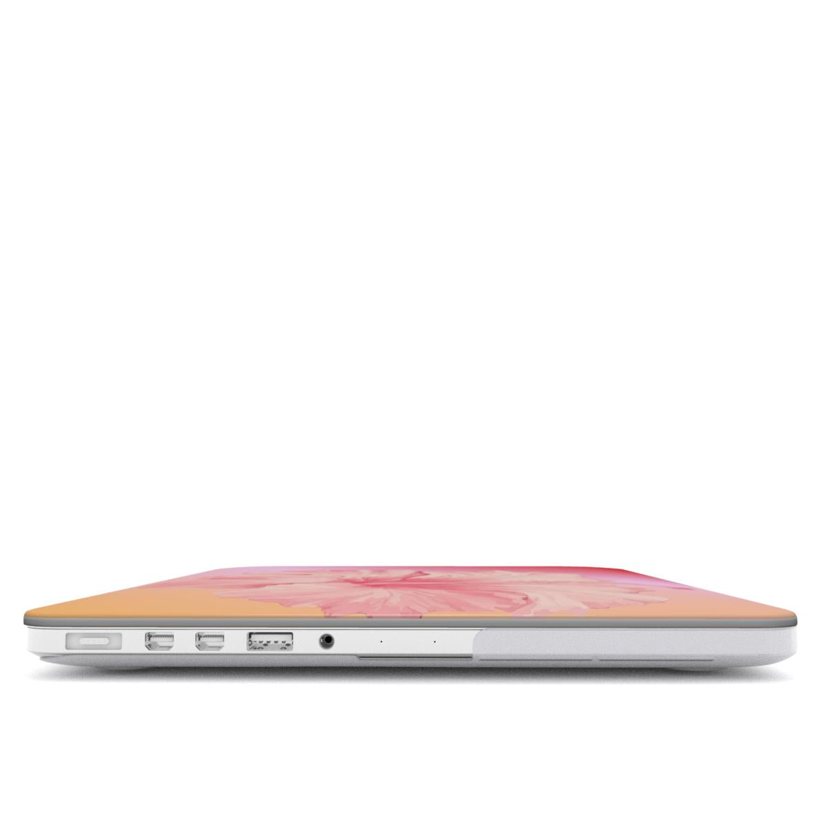 Pink Sunset Hibiscus Macbook Case