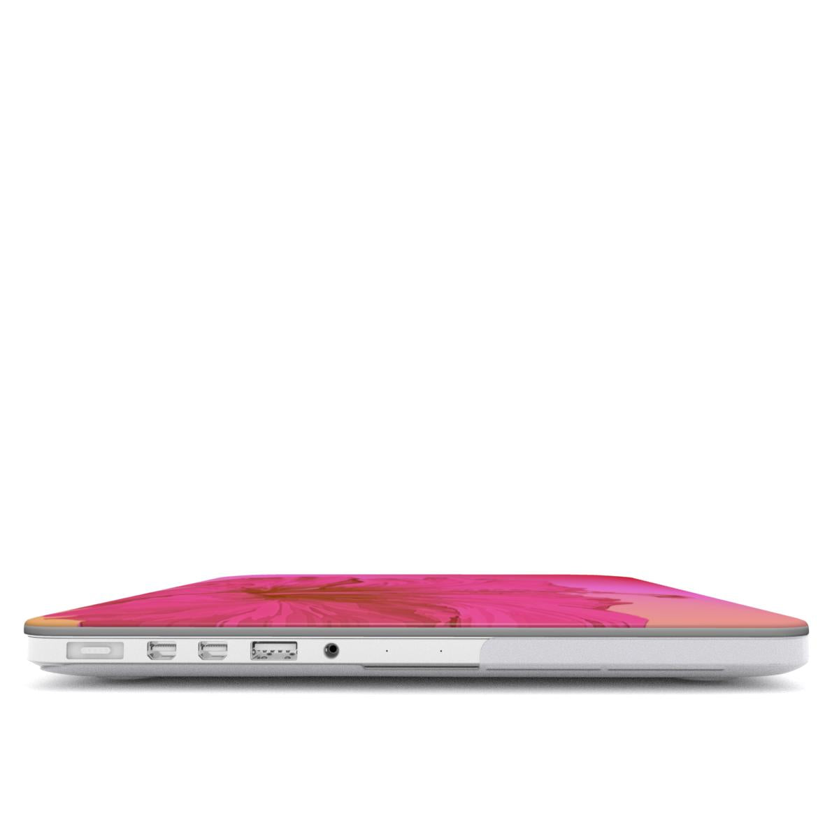 Hot Pink Sunset Hibiscus Macbook Case