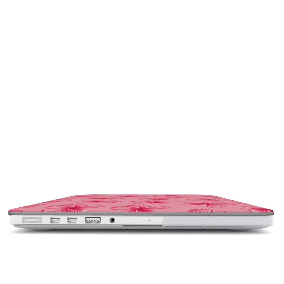 Pink Hibiscus Macbook Case