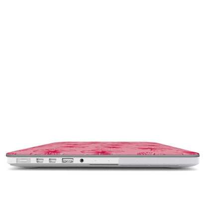 Pink Hibiscus Macbook Case