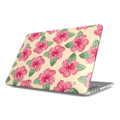 Hibiscus Shack Macbook Case