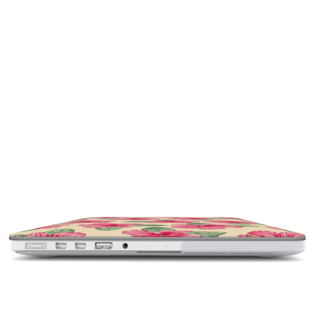 Hibiscus Shack Macbook Case