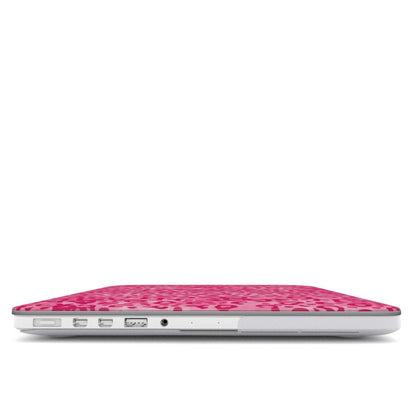 Pink Leopard Macbook Case